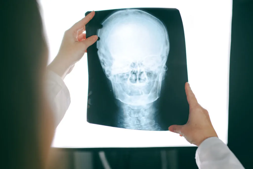 Precision Upper Cervical Diagnostic Biomechanical Alignment